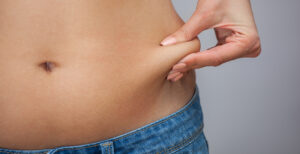 She pulls the skin of the abdomen