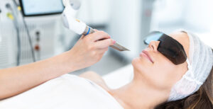 Close-up of beautiful woman receiving laser procedures for her face. Wearing protection glasses