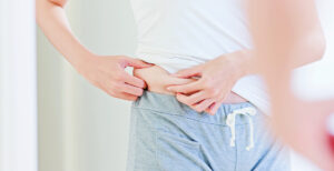 A woman pinching fat at her waist.