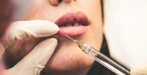 A woman receiving a Botox injection into her bottom lip.
