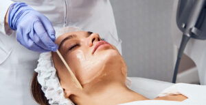 woman getting a chemical exfoliation facial by a professional